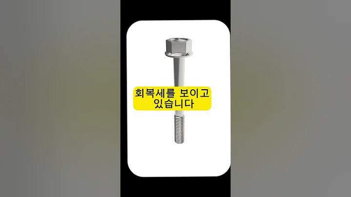 50억 자사주 매입한 와이엠, 저평가 돌파할까? | 자동차 부품 강소기업 집중 분석
