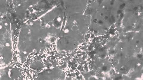 Hydrogel stiffness affects cardiac contraction in 3-D