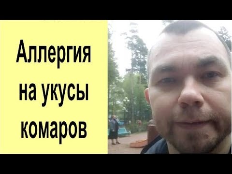 Cильная аллергия на укусы комаров у ребенка отзыв