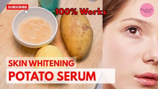 Potato Serum to Remove Dark Spots l Skin Whitening l 100% Result l 2020 l how to make.