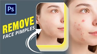 How to Remove pimples easily in photoshop  || #pimpleremove #photoshop #viral  #shorts #shortsvideo