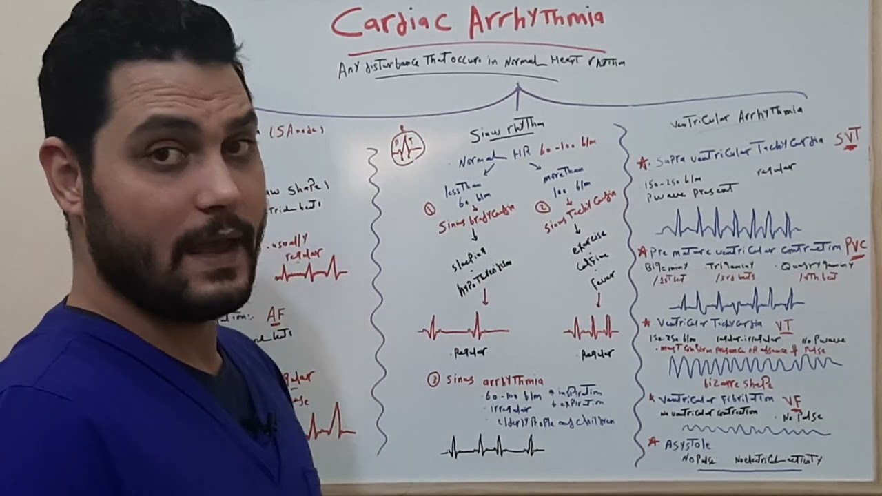 تعرف على أهم التغيرات فى رسم القلب.رسم القلب الجزء الثانى ECG ARRHYTHMIAS .AF.VT.VF. #NURSE_NOTE_1