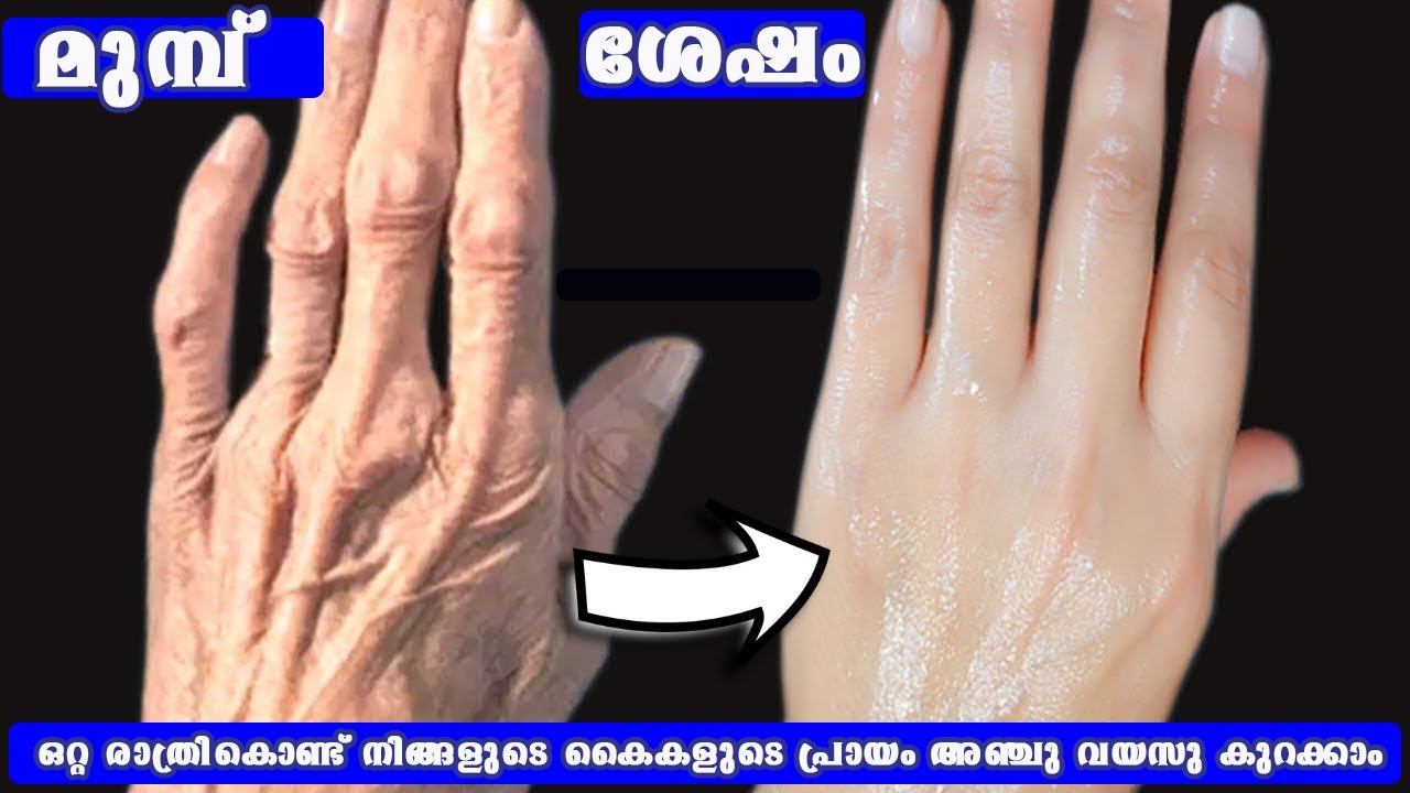 ഒറ്റ രാത്രികൊണ്ട്  നിങ്ങളുടെ കൈകളുടെ പ്രായം അഞ്ചു വയസ്സ് കുറയ്ക്കാം /special  easy Manicure