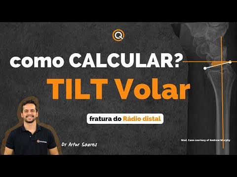 Anatomia do Pé no TARO 2021! Por Ricardo Villar #RevisandoComQuestões #TEOT  #SBOT #OQM 