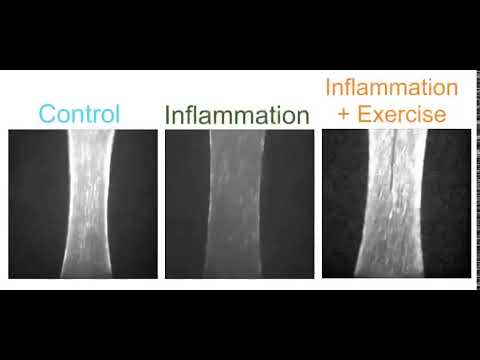 Contracting Muscle Bundles