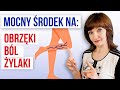 Mocny rodek na bl obrzki ng i ylaki zmniejsz ylaki odmd nogi 3 sposoby