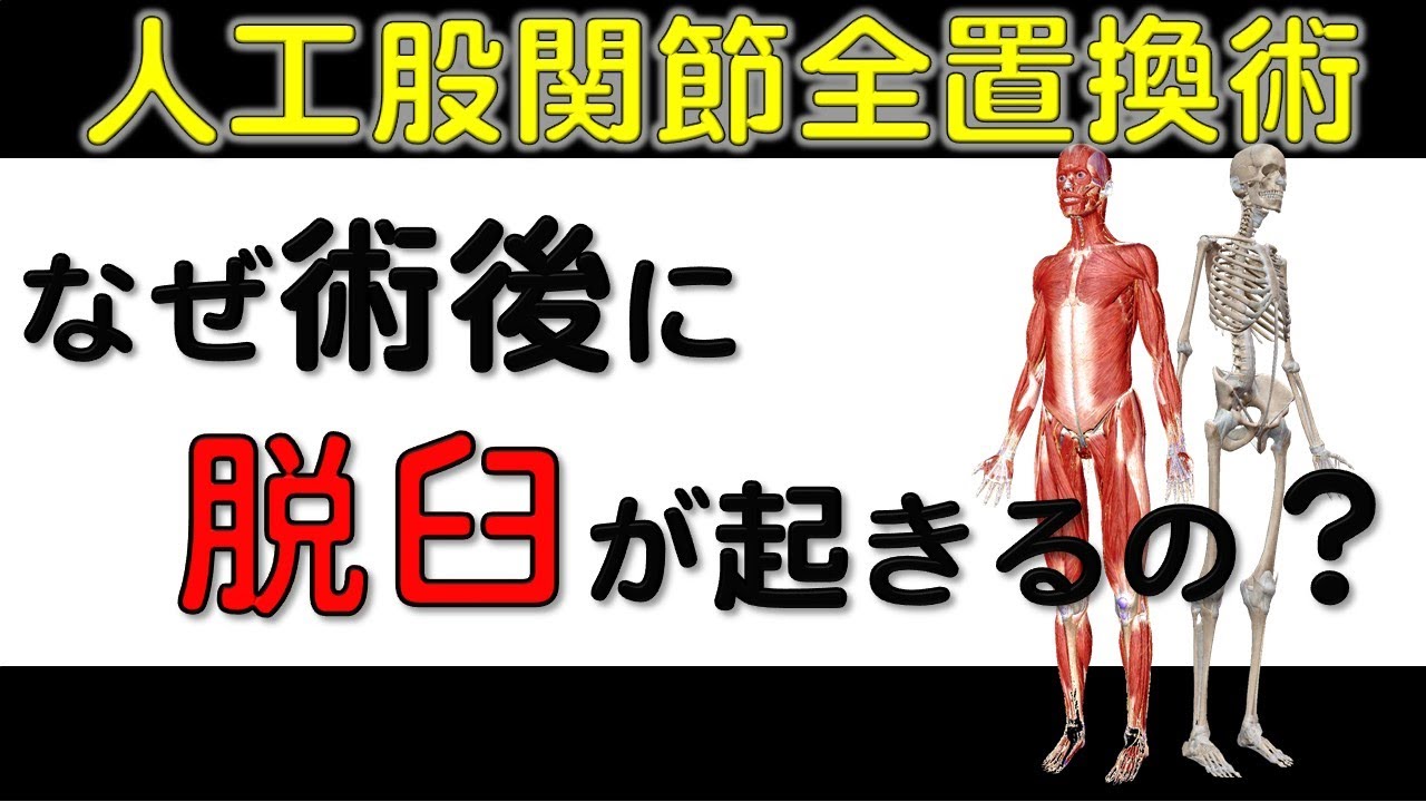 5. [Hip arthroplasty] Postoperative dislocation - Theory - YouTube