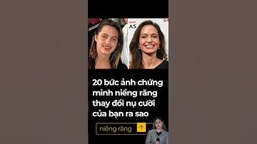 20 bức ảnh chứng minh niềng răng thay đổi nụ cười, thay đổi cuộc đời. Ngoại hình thay đổi cuộc sống