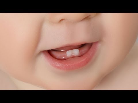Uşaqlarda süd dişləri nə vaxt çıxmalıdır?