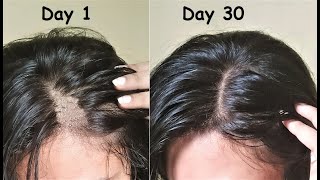 Castor Oil to Regrow New HAIR in 30 Days & Turn Thin Hair to Thick Hair | Hair Growth & Long Hair Guide