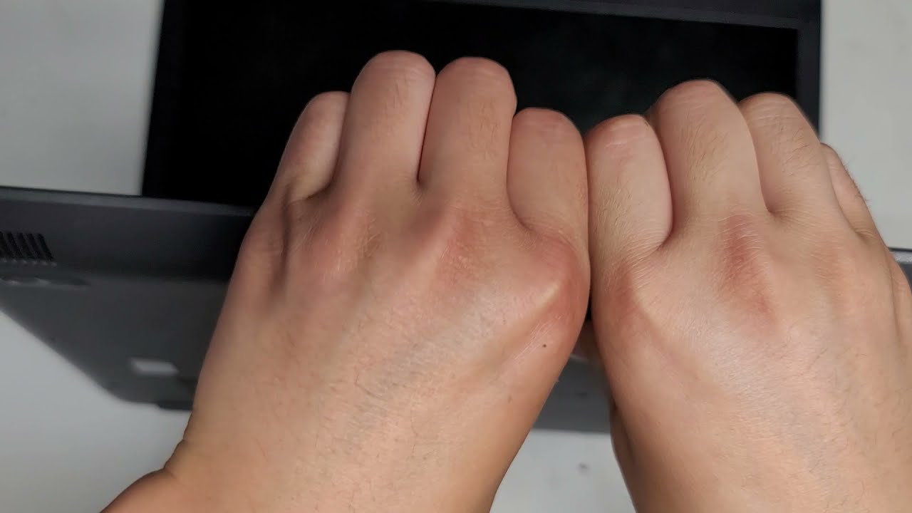 Lenovo IdeaPad 320-15IKB Disassembly RAM SSD Hard Drive Upgrade Repair Battery Replacement