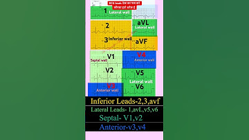 ECG leads & heart attack area l ईसीजी लीड्स के नाम #echo #ecg #shorts
