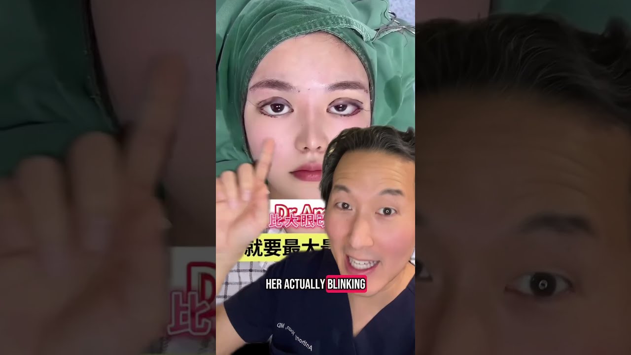 Some Asian Plastic Surgeons Are Insane 