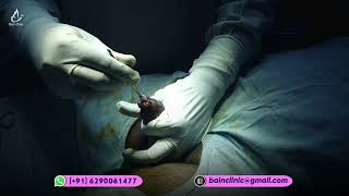 Hybrid Circision Surgery Dr. Jayanta Bain Plastic Surgeon In Kolkata