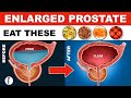 Prostate enlargement Treatment (Naturally) | Benign Prostatic Hyperplasia | Enlarged Prostate Diet