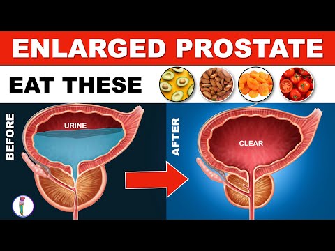 Video: 3 måder at reducere prostataforstørrelse på naturlig vis