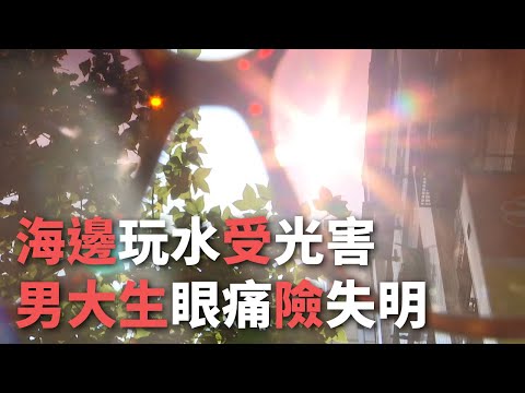 海邊玩水受光害 男大生眼痛險失明【央廣新聞】