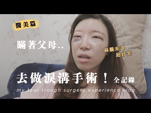 瞞著父母⋯去做淚溝手術！恢復期比預期久好多😢！醫美體驗全記錄Vlog，大成功👼！