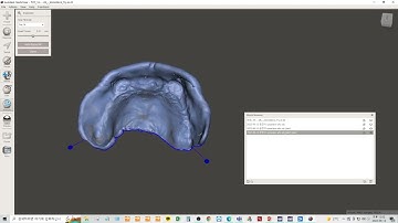 2022-06-12 Denture Design Part 2 - Mx. Base Replacement