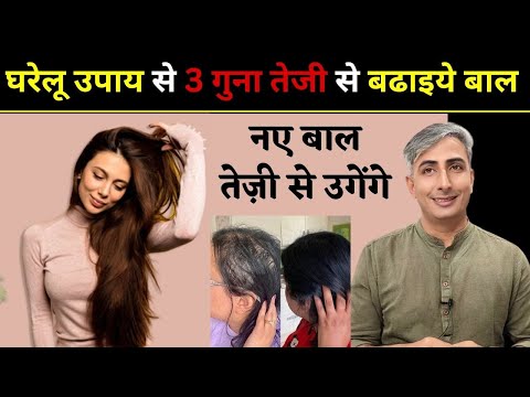 घरेलू उपाय से 3 गुना तेजी से बढाइये बाल I नए बाल तेज़ी से उगेंगे  I DR. MANOJ DAS