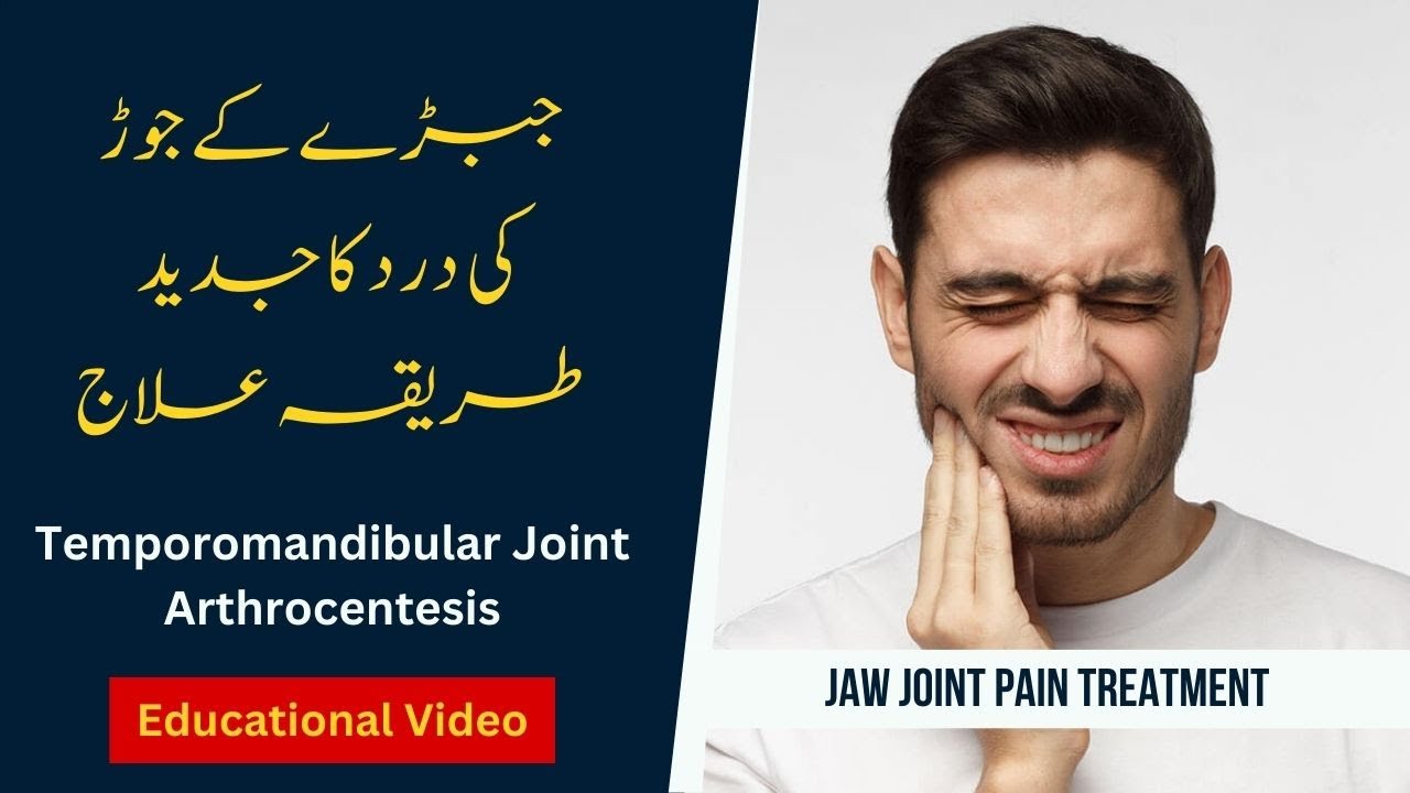 JAW JOINT PAIN Educational Video Temporomandibular Joint