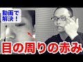 目の周りの湿疹原因とセルフケア【動画アドバイス】