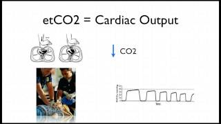 Capnography in Cardiac Arrest