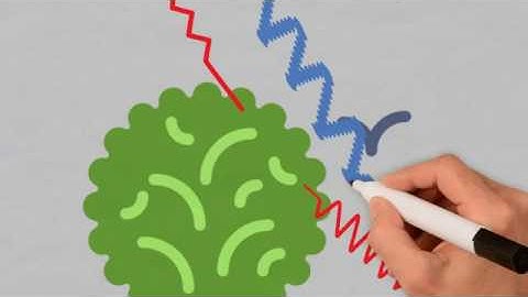 cycle slips-sebab akibat solusi