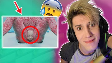 Co jsou dobré potraviny na podrážděný žaludek?