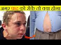 पाद को रोकने से क्या होगा? | What If You Held in All Your Farts? | Most Amazing Facts | FE Ep#75