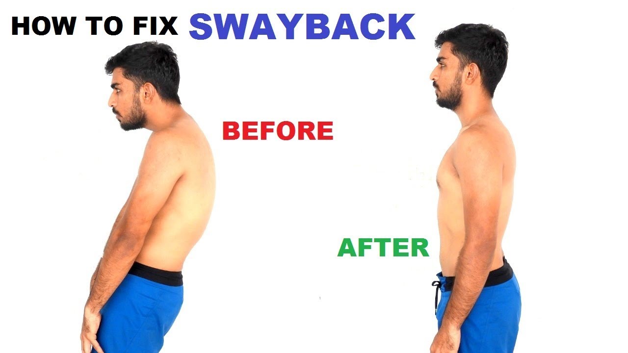 Back fix