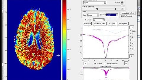 CEST MRI data evaluation tool part 2/2 - Lorentzian fitting
