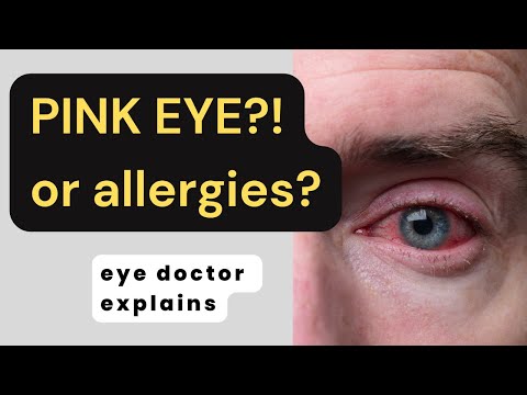Eye Allergies vs