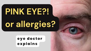 Eye Allergies Vs Conjunctivitis Allergy Eyes Vs Pink Eye Allergic Conjunctivitis