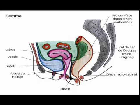 Video: O Procedură Anatomică De Economisire A Sfincterului Anal Pentru Cancerele Rectale Localizate La Joncțiunea Anorectală