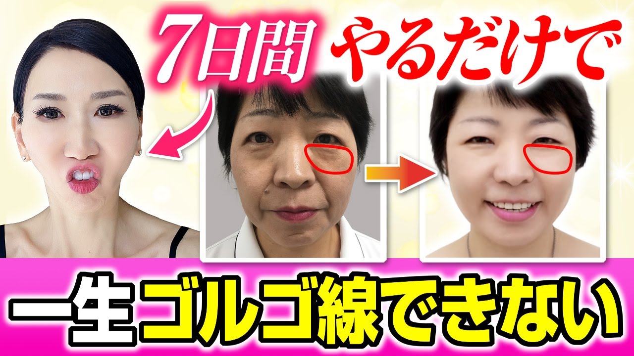 Improve Facial Sagging and Deep Wrinkles Around the Cheeks that