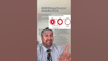 GCSE Biology: Blood and circulation Part 2. #gcse #biology #examrevision