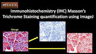 Immunohistochemistry IHC Massons Trichrome Staining quantification using ImageJ