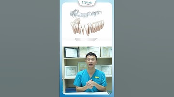 Tại Sao Niềng Răng Invisalign Chi Phí Lại Cao | Bác Sĩ Yên