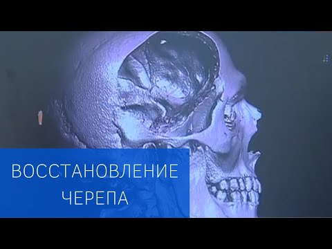Операция по восстановлению черепа