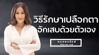 3 วิธีรักษา โรคเปลือกตาอักเสบที่บ้านไม่ต้องมาหาหมอ  คนตาอักเสบ 90% เป็นโรคนี้