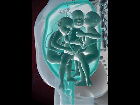 PRECIOUS MOMENTS OF TRIPLETS INSIDE THE WOMB 3D ANIMATION 