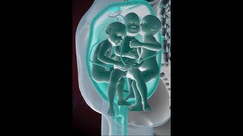 PRECIOUS MOMENTS OF TRIPLETS INSIDE THE WOMB  (3D ANIMATION)