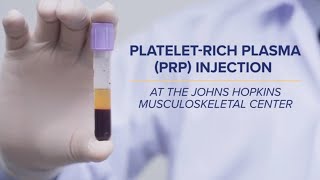 PlateletRich Plasma (PRP) Injections | Q&A