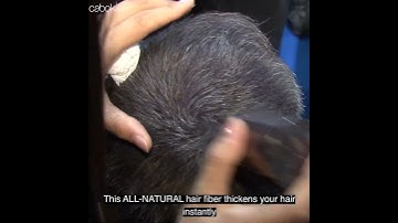 Hide Bald Spot Instantly