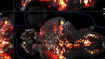 Whole-brain Imaging of Neuronal Activity with Cellular Resolution
