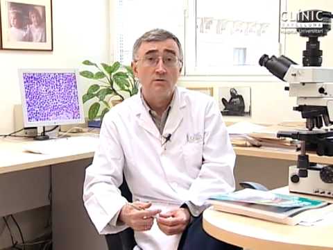 Se empieza a secuenciar el genoma de la leucemia