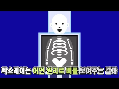 엑스레이를 찍으면 어떤 원리로 몸 속이 보이는 걸까