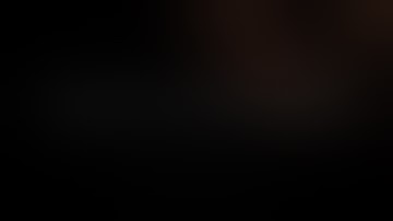 MANAGEMENT OF INTRAOCULAR LENS DISLOCATION