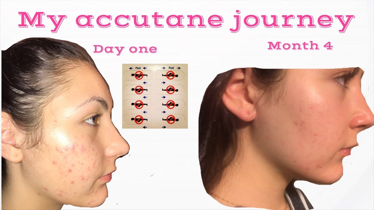 clomid 50mg price in dubai clomid 50mg price in dubai